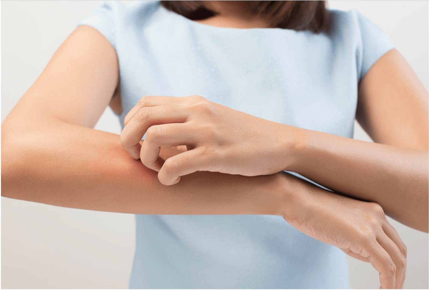 Lupus Demystified: Understanding the Condition and Coping with Its Effects