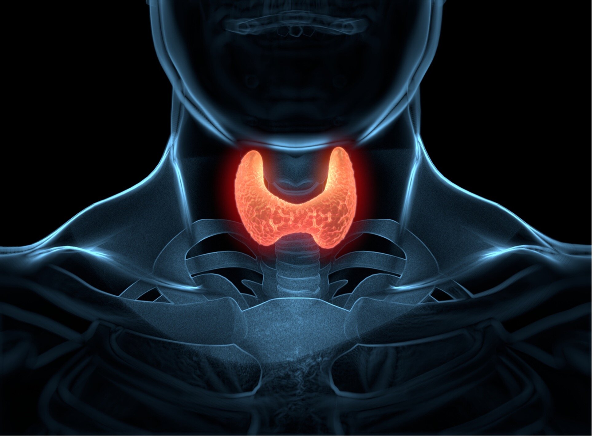 The Silent Disease: Understanding Thyroid Cancer